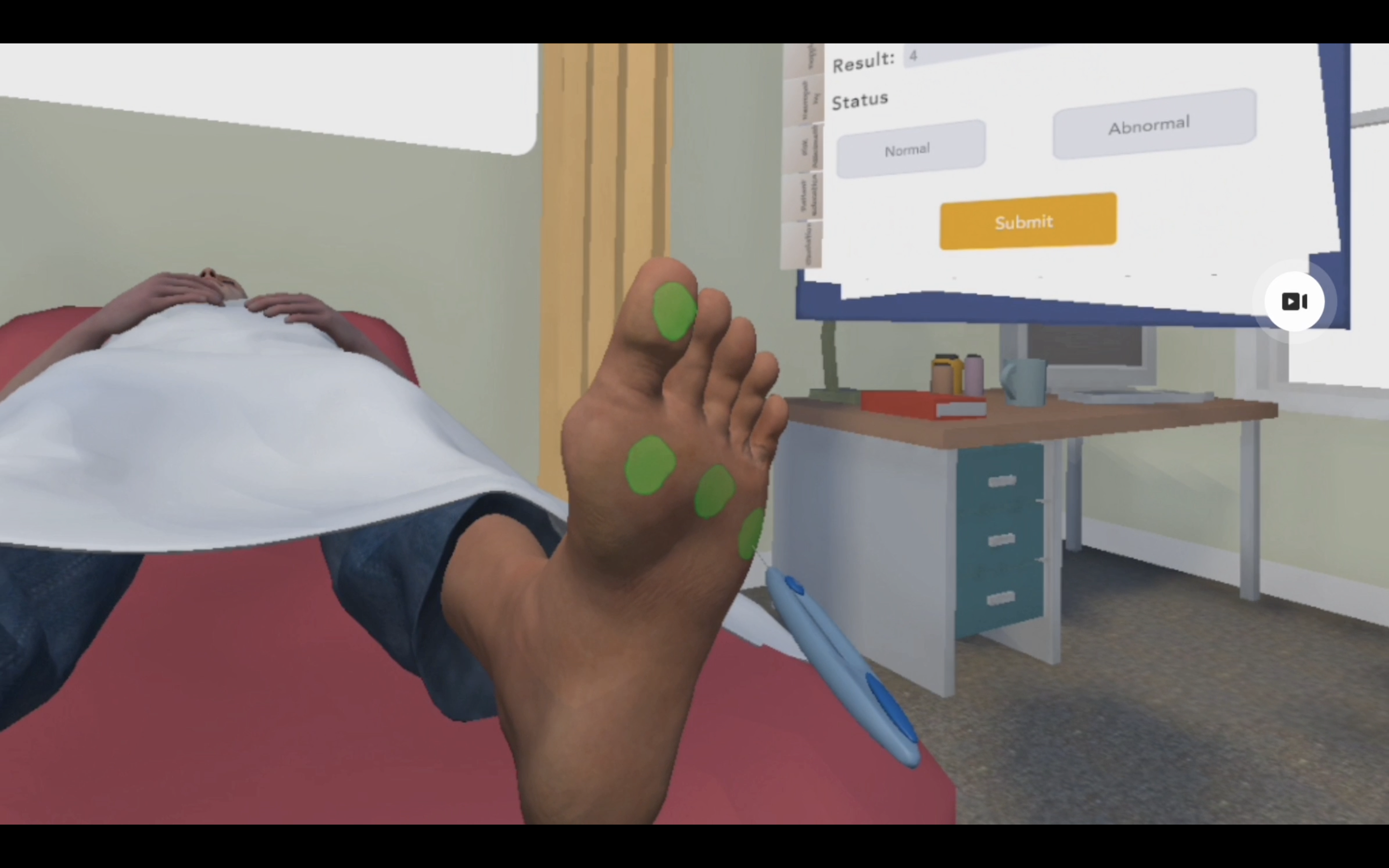 The VR simulation: a virtual patient's foot mid monofilament test, sensation points marked in green, with the case file open beside the bed.